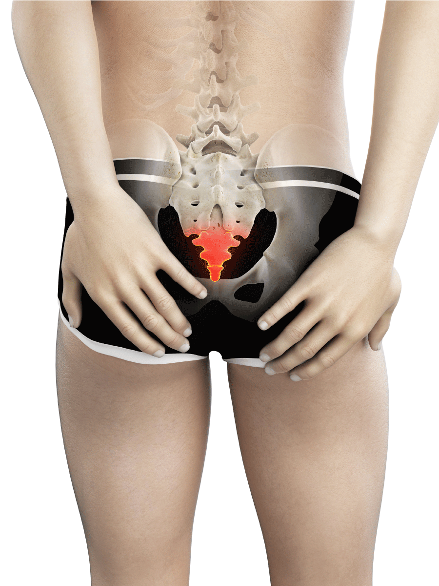 Tailbone Pain Relief Now! Causes and Treatments for Your Sore or Injured  Coccyx