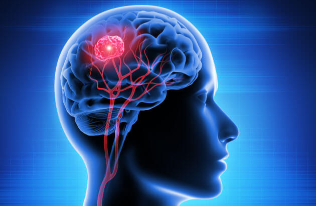 Brain Surgery Guide What To Expect Neurosurgery Spine Consultants