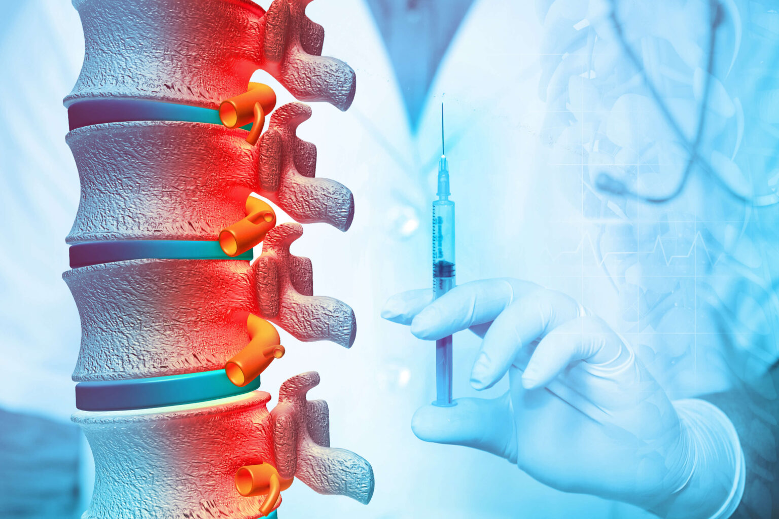 10 Types of Spinal Injections for Back Pain | NSC