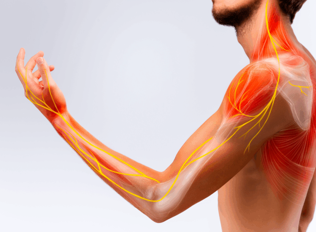 NSC_nerve_pain_quiz