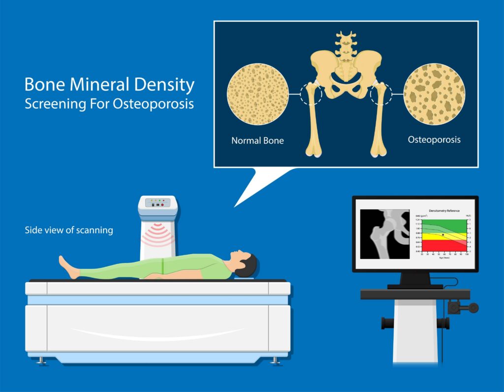 what_is_a_dexa_scan